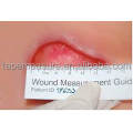 Dipsosable Medical Measurement Ruler For Wound